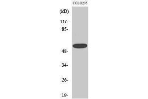 Western Blotting (WB) image for anti-Chloride Channel CLIC-Like 1 (CLCC1) (Internal Region) antibody (ABIN3174437) (CLCC1 抗体  (Internal Region))