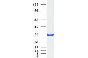 Western Blotting (WB) image for Malate Dehydrogenase 1, NAD (Soluble) (MDH1) protein (Myc-DYKDDDDK Tag) (ABIN2725670)
