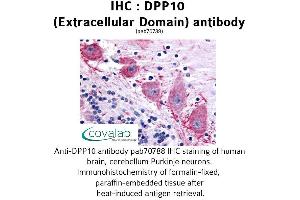 Image no. 1 for anti-Dipeptidylpeptidase 10 (DPP10) (Extracellular Domain) antibody (ABIN1733742) (DPP10 抗体  (Extracellular Domain))