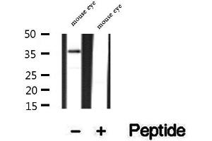 PRPH2 Antikörper  (Internal Region)