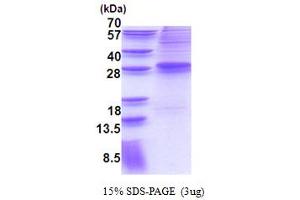 SDS-PAGE (SDS) image for MDS1 and EVI1 Complex Locus (MECOM) (AA 1-169) protein (His tag) (ABIN6387329) (MECOM Protein (AA 1-169) (His tag))