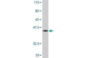 Western Blot detection against Immunogen (45. (PDAP1 抗体  (AA 1-181))