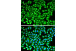 Immunofluorescence analysis of A549 cells using KAT5 antibody (ABIN6292501). (KAT5 抗体)