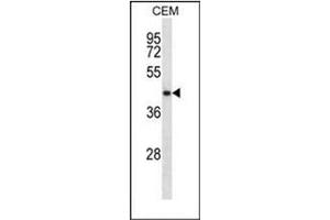 Western blot analysis of NDRG2 Antibody (N-term) in CEM cell line lysates (35ug/lane). (NDRG2 抗体  (N-Term))