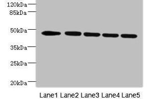 Western blot All lanes: DCXR antibody at 4. (VRK1 抗体  (AA 257-396))
