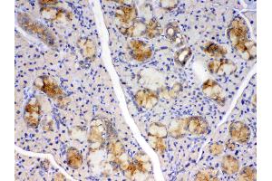 Immunohistochemistry (IHC) image for anti-Cyclophilin B (PPIB) (AA 158-216) antibody (ABIN5519055)
