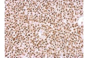 IHC-P Image BCCIP antibody detects BCCIP protein at nucleus on BT483 xenograft by immunohistochemical analysis.