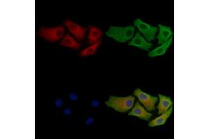 ABIN7093524 and ABIN7097548 staining Hela cells by IF/ICC. (RAB5 抗体)