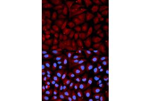 Immunofluorescence analysis of U2OS cell using SERPINC1 antibody. (SERPINC1 抗体  (AA 33-185))