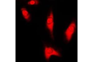 Immunofluorescent analysis of DJ-1 staining in HeLa cells. (PARK7/DJ1 抗体  (Center))