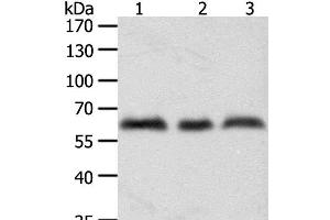 Western Blot analysis of A375, Hela and Jurkat cell using TYR Polyclonal Antibody at dilution of 1:600 (TYR 抗体)