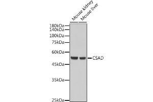 Western blot analysis of extracts of various cell lines, using CSAD antibody (ABIN6133497, ABIN6139087, ABIN6139088 and ABIN6217983) at 1:5000 dilution. (CSAD 抗体  (AA 371-520))