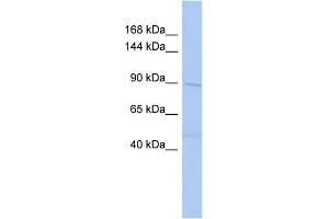 WB Suggested Anti-DNMT3B Antibody Titration:  0. (DNMT3B 抗体  (Middle Region))