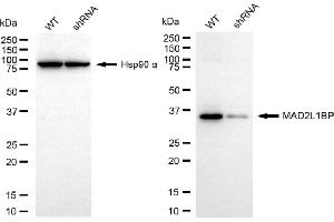 anti-MAD2L1 Binding Protein (MAD2L1BP) antibody