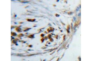 Used in DAB staining on fromalin fixed paraffin-embedded lung tissue (KDM4A 抗体  (AA 141-310))