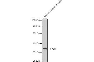 Western blot analysis of extracts of mouse skeletal muscle, using FRZB antibody (ABIN6131654, ABIN6140777, ABIN6140778 and ABIN6222275) at 1:1000 dilution. (FRZB 抗体  (AA 166-325))