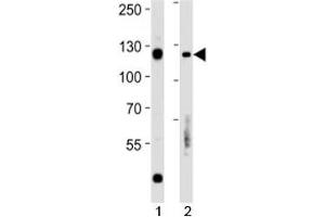 Rb antibody western blot analysis in 1) Daudi and 2) Raji lysate. (Retinoblastoma Protein (Rb) 抗体  (AA 586-615))