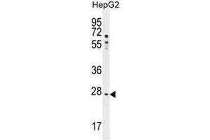 NR0B2 Antibody (Center)(PEI 1/100) western blot analysis in HepG2 cell line lysates (35µg/lane).