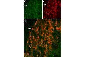 Expression of KV11. (KCNH6 抗体  (Intracellular))