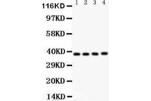 Anti- IKB beta Picoband antibody, Western blotting All lanes: Anti IKB beta  at 0.