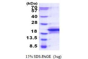 Motile Sperm Domain Containing 1 (MOSPD1) (AA 1-158) protein (His tag)