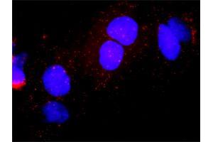 Proximity Ligation Analysis of protein-protein interactions between CDK7 and E2F1. (E2F1 抗体  (AA 348-437))