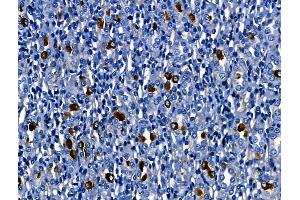 ABIN6260502 and ABIN6268715 at 1/100 staining Mouse colorectal tissue by IHC-P.