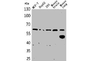 Western Blot analysis of MCF7 HepG2 293 mouse brain mouse lung cells using ZKSCAN4 Polyclonal Antibody (ZKSCAN4 抗体  (Internal Region))