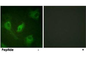 Immunofluorescence analysis of HeLa cells, using NFKBIE polyclonal antibody . (NFKBIE 抗体)