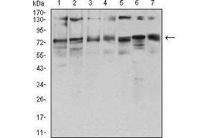 Western Blotting (WB) image for anti-Glutamine--Fructose-6-Phosphate Transaminase 1 (GFPT1) (AA 536-681) antibody (ABIN5542686)