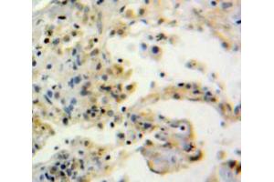 Used in DAB staining on fromalin fixed paraffin-embedded Lung tissue (Thimet Oligopeptidase 1 抗体  (AA 451-597))