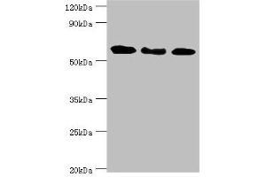 Western blot All lanes: Interferon-induced guanylate-binding protein 1 antibody at 4 μg/mL Lane 1: MM231 whole cell lysate Lane 2: Hela whole cell lysate Lane 3: MGF-7 whole cell lysate Secondary Goat polyclonal to rabbit IgG at 1/10000 dilution Predicted band size: 68 kDa Observed band size: 68 kDa (GBP1 抗体  (AA 383-592))