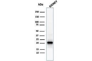 Western Blot Analysis of human kidney tissue lysate using Ferritin, Light Chain Mouse Monoclonal Antibody (FTL/1386). (FTL 抗体  (AA 38-165))