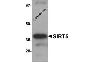 Western Blotting (WB) image for anti-Sirtuin 5 (SIRT5) (C-Term) antibody (ABIN1030665) (SIRT5 抗体  (C-Term))