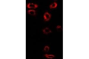 Immunofluorescent analysis of Syntenin staining in SW480 cells. (SDCBP 抗体)