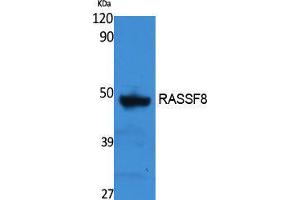 Western Blotting (WB) image for anti-Ras Association (RalGDS/AF-6) Domain Family (N-terminal) Member 8 (RASSF8) (Internal Region) antibody (ABIN3178131) (RASSF8 抗体  (Internal Region))