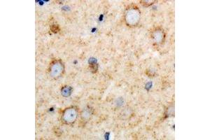Immunohistochemical analysis of DARS staining in rat brain formalin fixed paraffin embedded tissue section. (DARS 抗体)