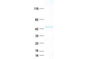 Western Blotting (WB) image for Cell Death-Inducing DFFA-Like Effector C (CIDEC) protein (GST tag,His tag) (ABIN5505590)