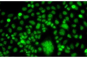 Immunofluorescence analysis of A549 cells using PPAN Polyclonal Antibody (PPAN 抗体)