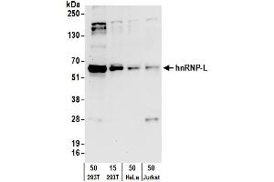 Western Blotting (WB) image for anti-Heterogeneous Nuclear Ribonucleoprotein L (HNRNPL) (AA 350-400) antibody (ABIN7795591) (HNRNPL 抗体  (AA 350-400))