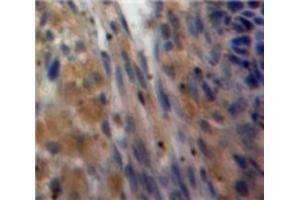 Used in DAB staining on fromalin fixed paraffin-embedded Ovary tissue (Inhibin alpha 抗体  (AA 233-366))