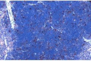 Immunohistochemistry (Paraffin-embedded Sections) (IHC (p)) image for anti-Cyclin-Dependent Kinase 6 (CDK6) antibody (ABIN2855743)