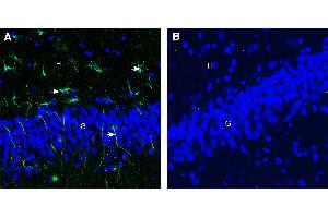 Expression of CD9 in rat hippocampus. (CD9 抗体  (Extracellular))