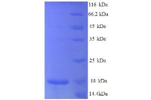 SDS-PAGE (SDS) image for Chemokine (C-C Motif) Ligand 25 (CCL25) (AA 25-144), (partial) protein (His tag) (ABIN4976873) (CCL25 Protein (AA 25-144, partial) (His tag))