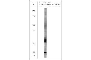WB on rat brain lysate using Rabbit antibody to VGluT1  at 1:300 dilution. (SLC17A7 抗体)