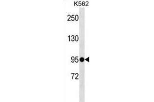 Western Blotting (WB) image for anti-Extracellular Leucine-Rich Repeat and Fibronectin Type III Domain Containing 1 (ELFN1) antibody (ABIN3000484)