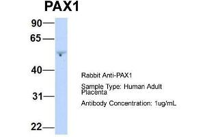 Host:  Rabbit  Target Name:  PAX1  Sample Type:  Human Adult Placenta  Antibody Dilution:  1. (PAX1 抗体  (Middle Region))