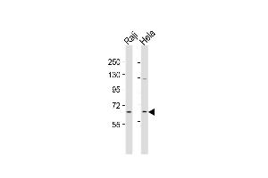 Western Blot at 1:2000 dilution Lane 1: Raji whole cell lysates Lane 2: Hela whole cell lysates Lysates/proteins at 20 ug per lane. (MLLT1 抗体  (C-Term))