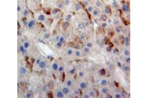 Used in DAB staining on fromalin fixed paraffin-embedded Liver tissue (ABCB11 抗体  (AA 420-656))