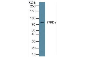 Western Blotting (WB) image for Transglutaminase 2 (C Polypeptide, Protein-Glutamine-gamma-Glutamyltransferase) (TGM2) ELISA Kit (ABIN6574289)